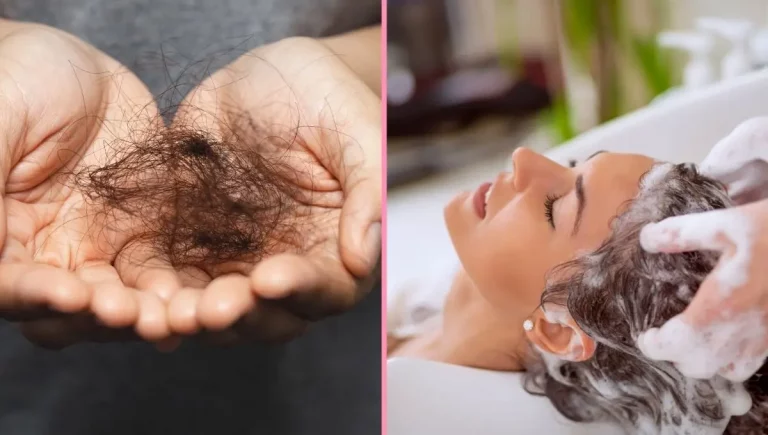 que provoca la caida del cabello